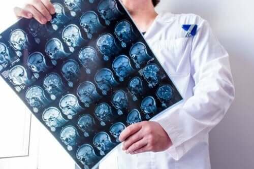 En lege som ser på hjerneskanninger.