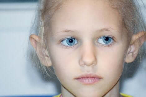 Barn med retinoblastom