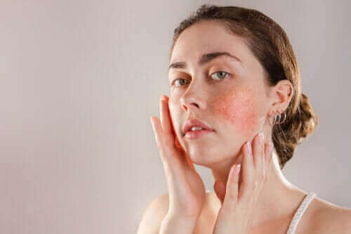 Reaktiv hud: symptomer, årsaker og behandling