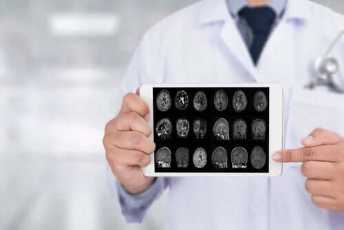 lege holder bilder av hjernen