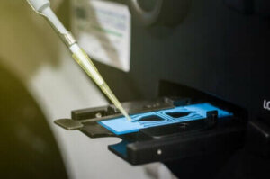 Hvordan tolke resultatene av en sædprøve