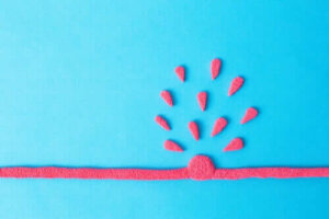 Abdominal aortaaneurisme: Symptomer og behandling