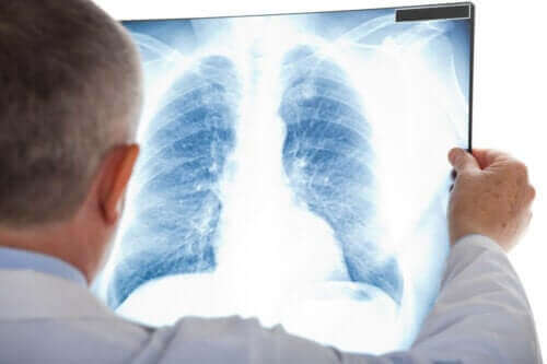 Hva er atypisk lungebetennelse?
