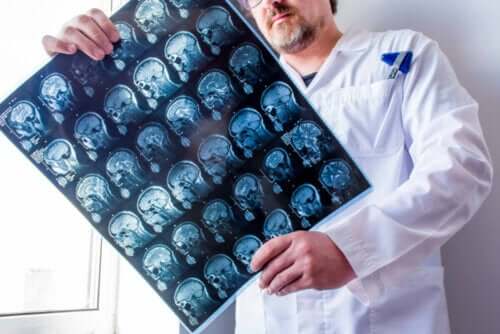 En lege med en CT-scan av hjernen