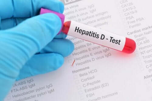 Hepatitt D-prøve