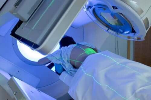 Bruk av strålebehandling for å drepe kreftceller.