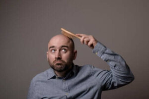 Alt om de forskjellige typene alopecia