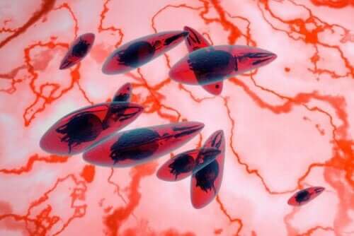 Mikroskopisk bilde av okulær toksoplasmose