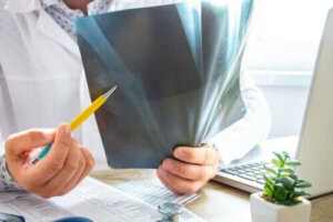 Benmargsødem: alt du trenger å vite