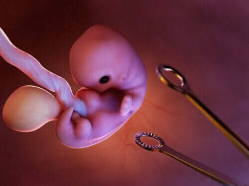 Provosert abort: hva innebærer det?