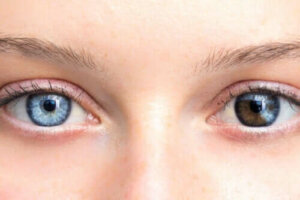 Endringer i øyenfarge kan være grunn for bekymring