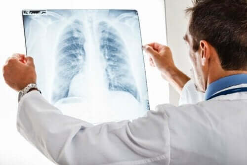 Et røntgen av en lunge.