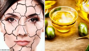 Enkle og naturlige måter å lindre tørr hud på