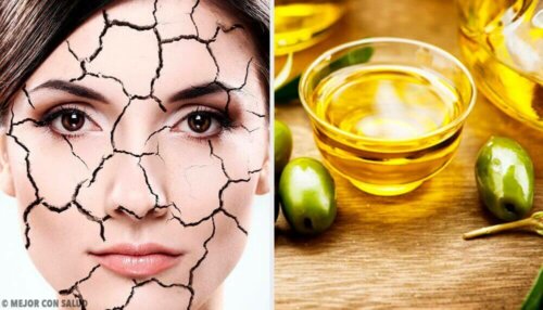 Enkle og naturlige måter å lindre tørr hud på