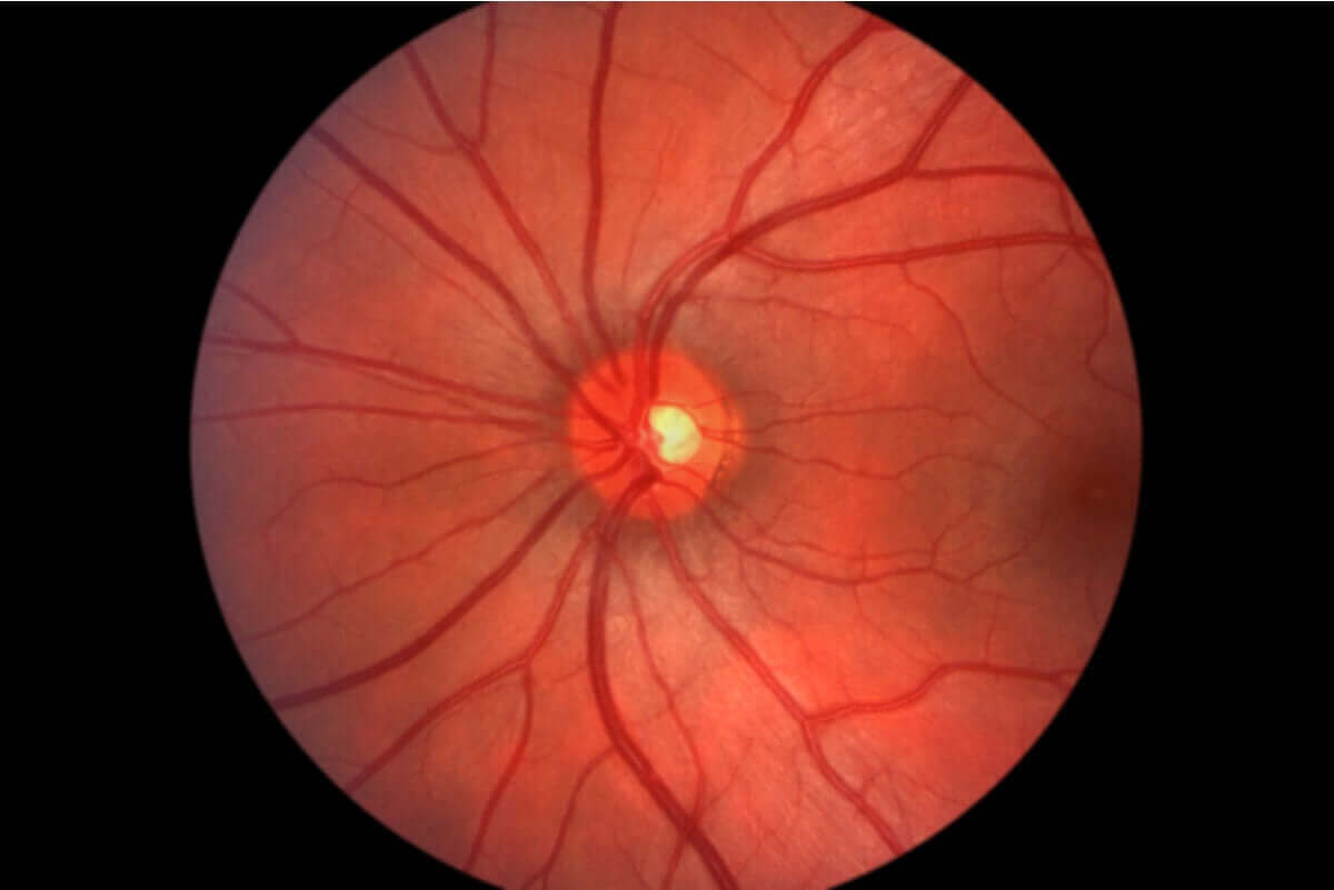 Øyens fundus