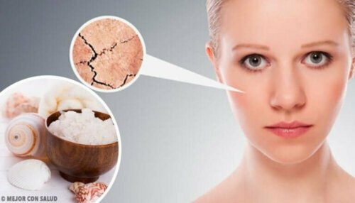 5 naturlige remedier for å bli kvitt tørr hud