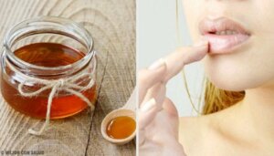 6 naturlige remedier for sprukne lepper