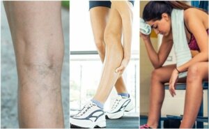 6 ting som kan forårsake muskelkramper