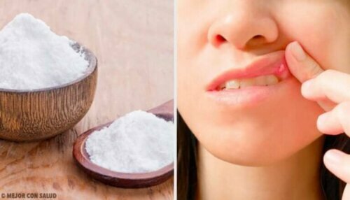 8 remedier som kan hjelpe til med å helbrede munnsår