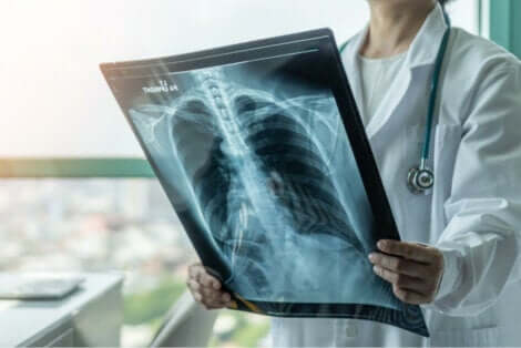En kvinnelig lege som ser på et lungerøntgen.