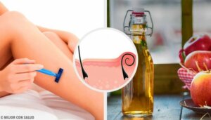 Fem naturlige remedier mot irritasjon etter barbering