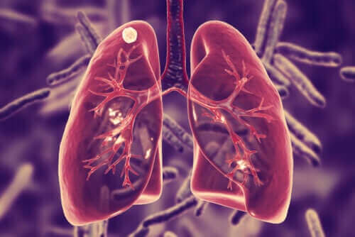 Hva er lungetuberkulose og hva er symptomene?
