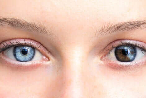 Kvinne med to forskjellige farger på øynene.