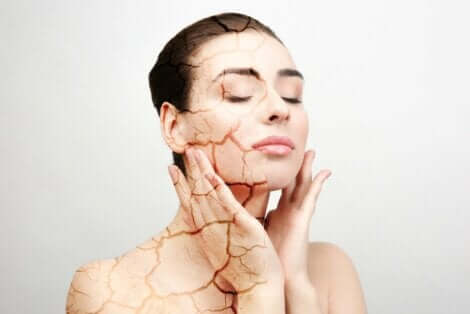 Kvinne med tørr hud berører ansiktet sitt.