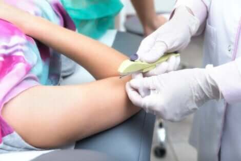 Kvinne som får satt inn en p-stav.