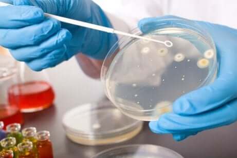 Seksuelt overførbare sykdommer,: bakterier i et laboratorium