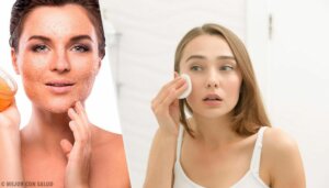 Tips for å behandle tørr hud en gang for alle