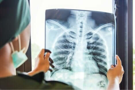 Et røntgenbilde av lungene.