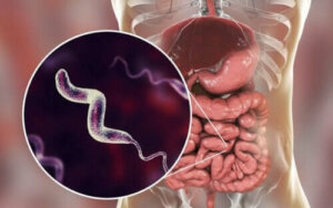 Kjennetegn ved campylobacterinfeksjoner