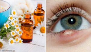 5 enkle triks for å behandle sti på øyet