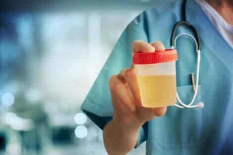 En medisinsk fagperson som holder en urinprøve.