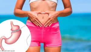 Fordeler med og komplikasjoner etter gastrisk bypass-operasjon