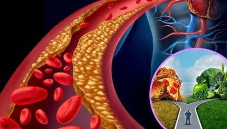 Optimale kolesterolnivåer og dets varianter