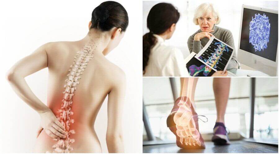 Osteoporose kan føre til til smerter i skulderbladet