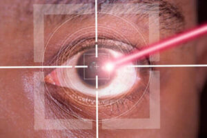 Fordeler og ulemper ved LASIK-kirurgi