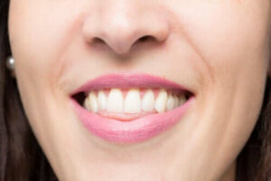 Hva er et åpent bitt og hvordan korrigeres det?