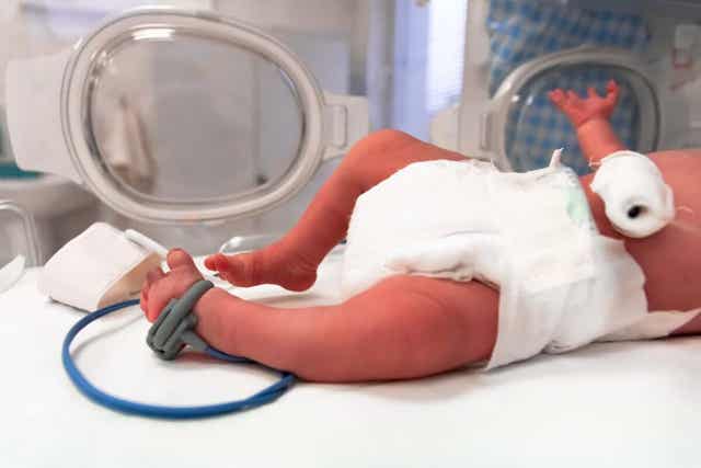 En for tidlig født baby