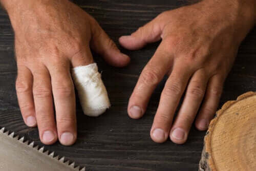 Førstehjelp ved traumatisk amputasjon av en finger
