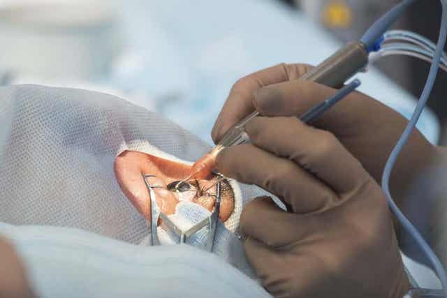 En pasient som gjennomgår synsoperasjon