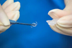 Intraokulær linseoperasjon: Når er det nødvendig?