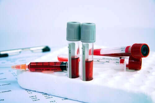 Alt du trenger å vite om hematologiske sykdommer