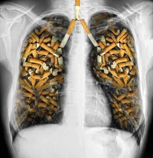 Vareniklin kan hjelpe røykere.