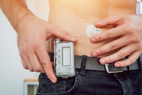 Hva er insulinpumper?