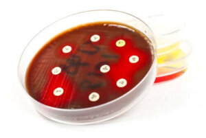 Hva er bruksområdene til et antibiogram?