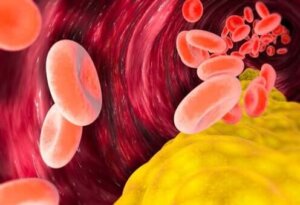 Er VLDL-kolesterol skadelig?