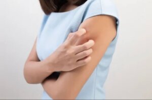 Atopisk eksem: Hva er det og hva forårsaker det?